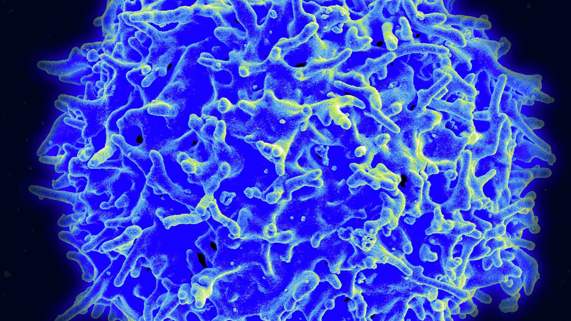 Ученые оценили роль клеточного иммунитета в борьбе с COVID-19 