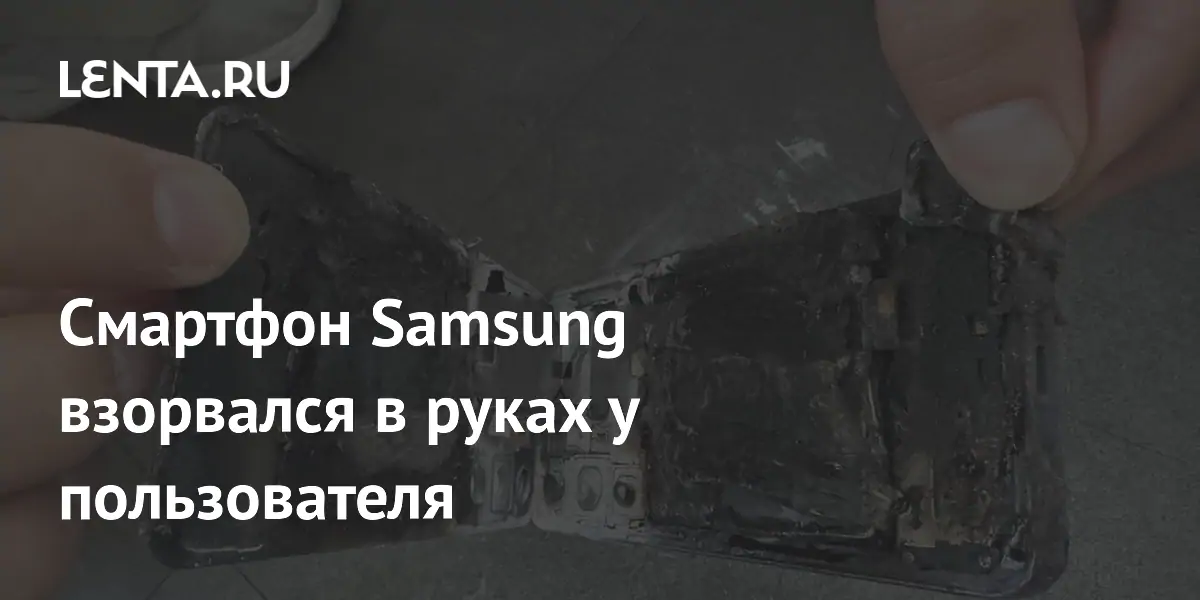 Samsung Galaxy S24 взорвался в руках южнокорейского пользователя: пострадавший получил ожог и психологическую травму