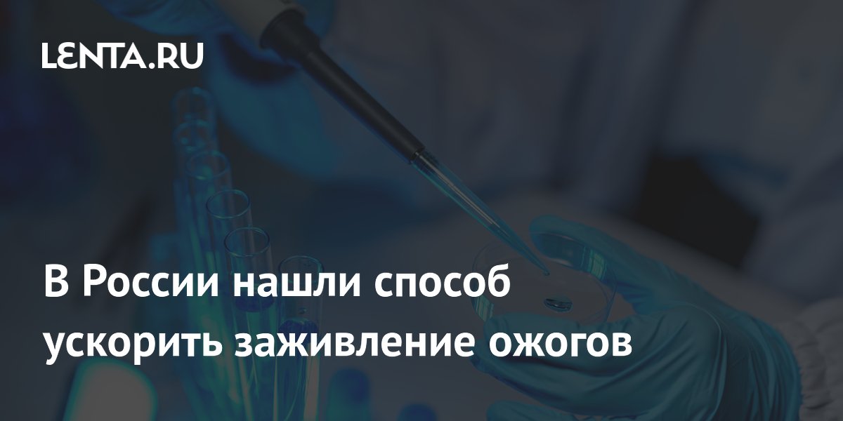 Сеченовский университет создал гидрогель для ускоренного заживления ожогов