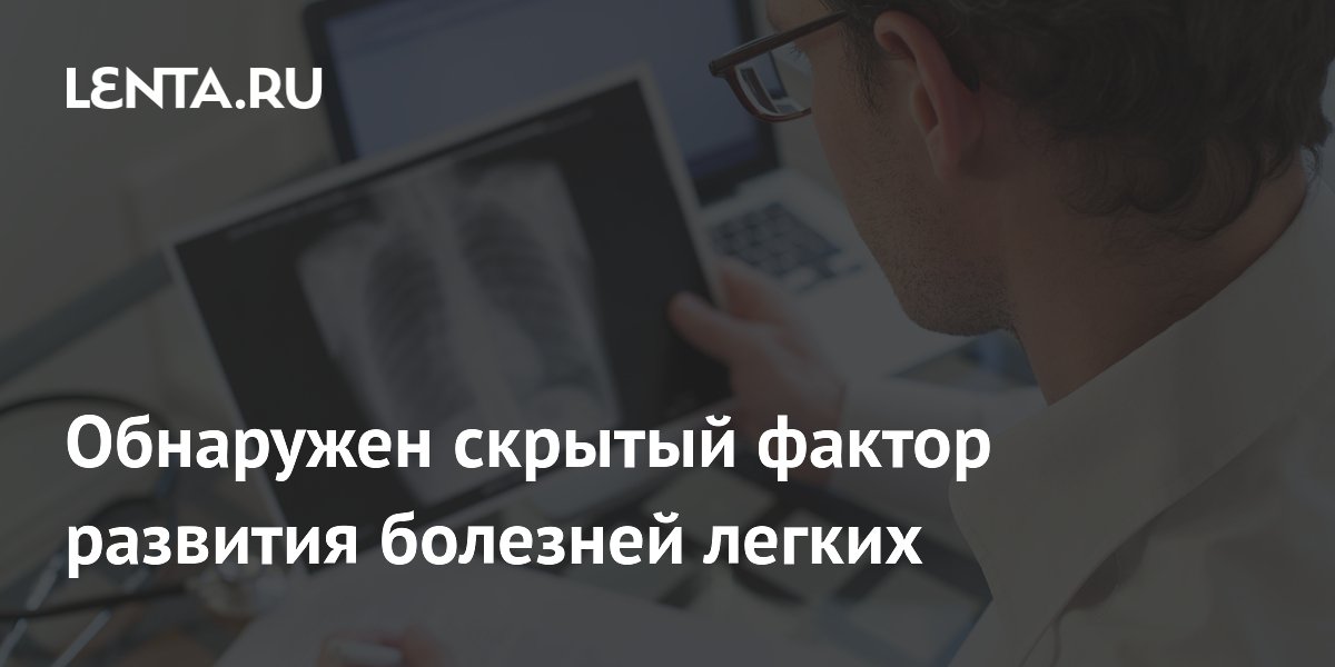 Скрытый белок DPP9 повышает риск тяжелого COVID-19 и фиброза легких Скрытый белок DPP9 повышает риск тяжелого COVID-19 и фиброза легких