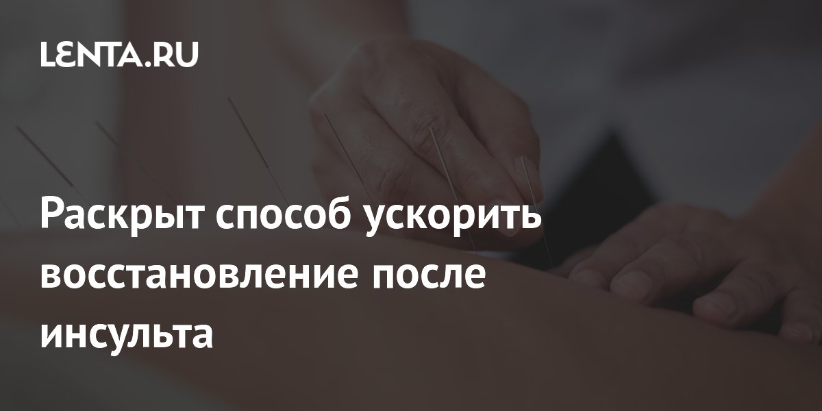 Иглоукалывание ускоряет восстановление после инсульта: исследование Иглоукалывание ускоряет восстановление после инсульта: исследование