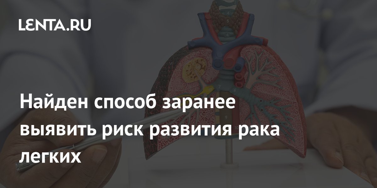 Анализ крови предскажет рак легких за 5 лет: выявлены 14 белков-маркеров Анализ крови предскажет рак легких за 5 лет: выявлены 14 белков-маркеров