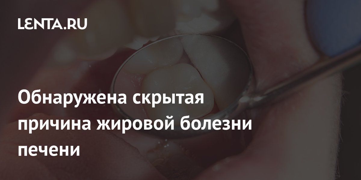 Китайские учёные нашли связь между болезнями дёсен и жировой болезнью печени Китайские учёные нашли связь между болезнями дёсен и жировой болезнью печени