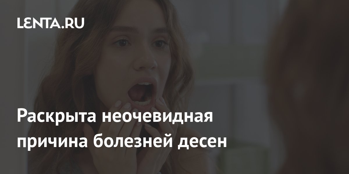 Раскрыта неочевидная причина болезней десен: виноват кишечник