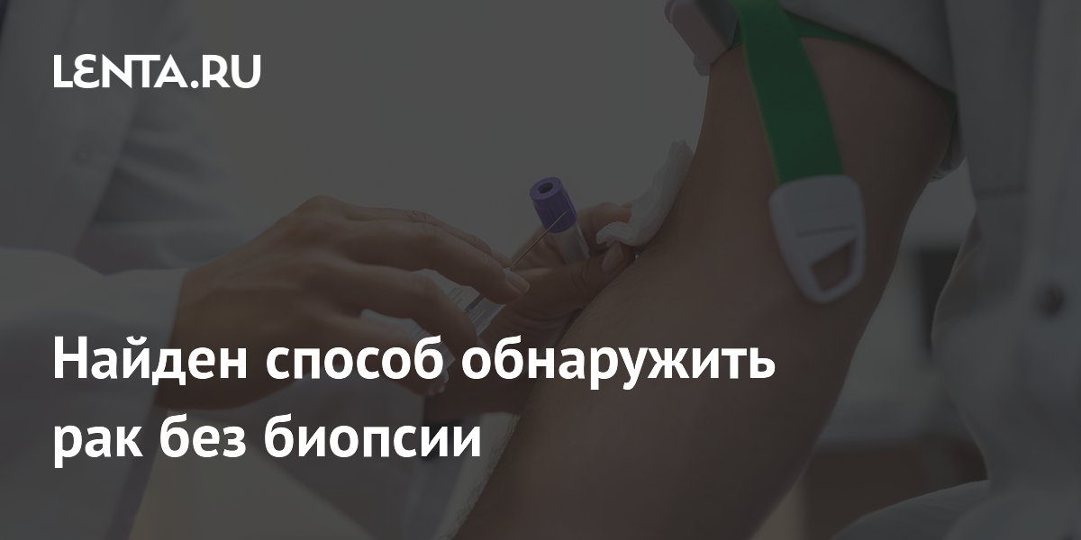 Новый анализ крови выявляет рак при 5% опухолевой ДНК