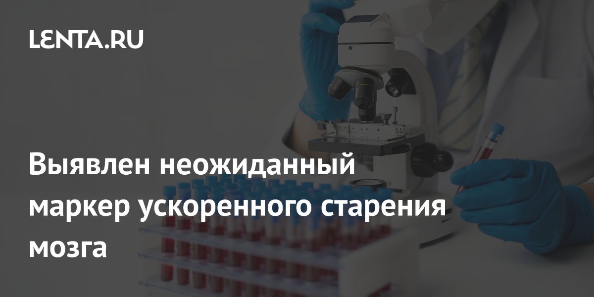 Повышенный уровень глюкозы в крови ускоряет старение мозга