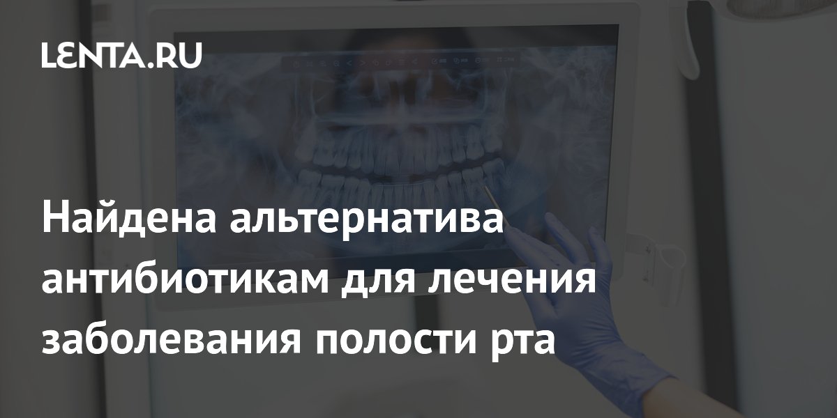 Омега-3 и аспирин могут заменить антибиотики при лечении пародонтита