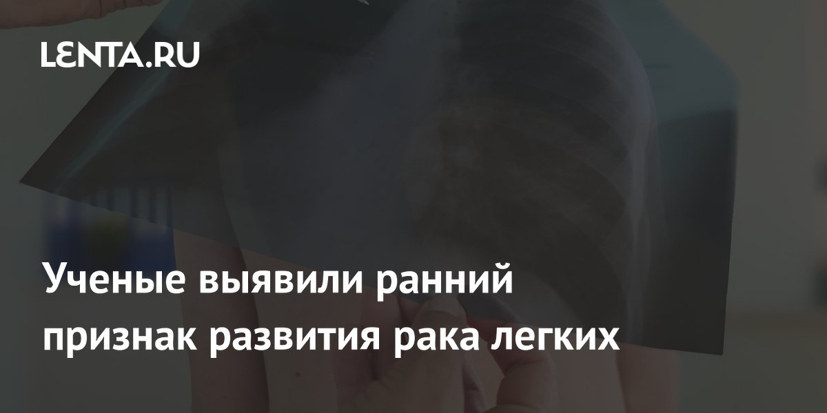 Молекулярные следы в крови укажут на риск рака легких за годы до диагноза